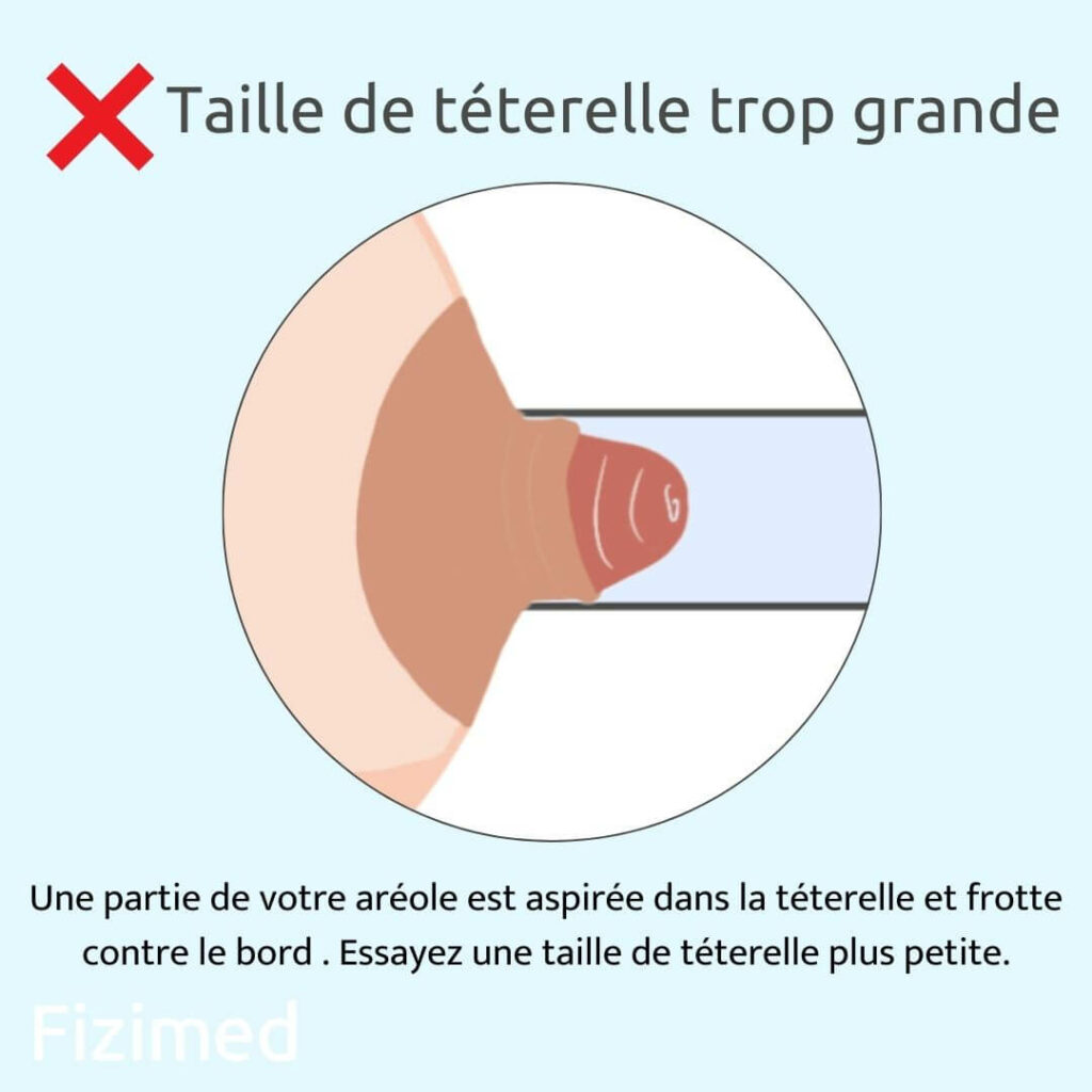 taille téterelle non adaptée car aréole est aspirée 